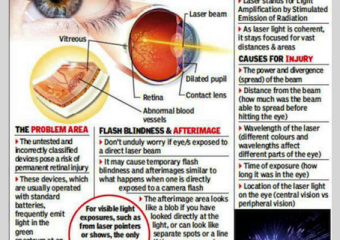 MAJOR FACTORS THAT AFFECTED ON EYES