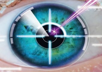 NIO LAUNCHES ADVANCED TREATMENT FOR DRY EYE IN PUNE