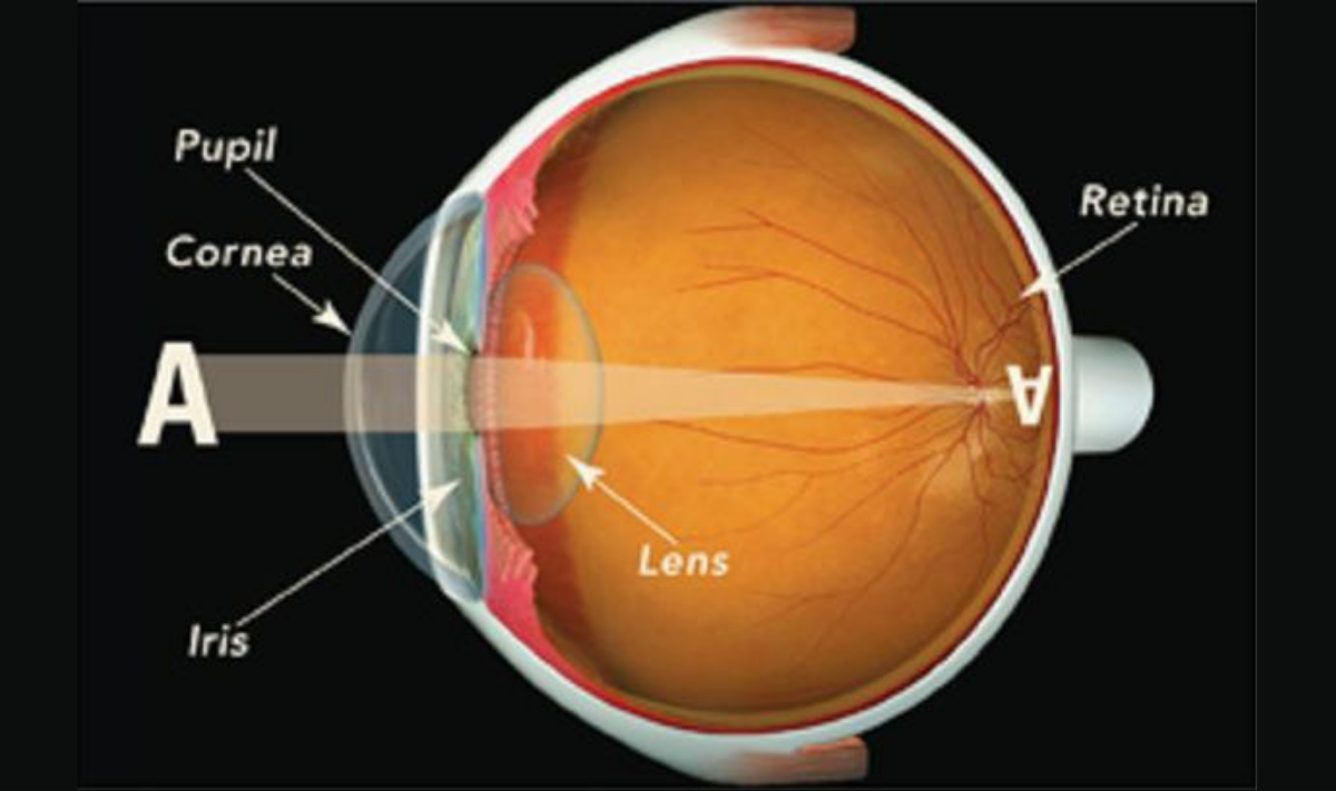 Diabetic Retinopathy