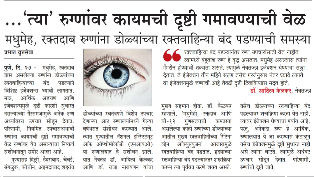 retinal vein oclusion